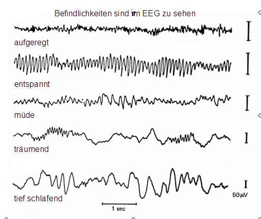 Datei:Befindlichkeiten sind im EEG zu sehen.jpg